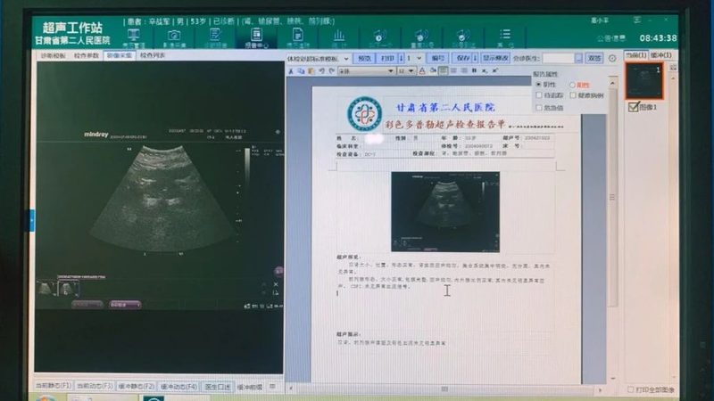 高端防癌体检加盟代理：揭秘防癌体检的“幕后黑手
